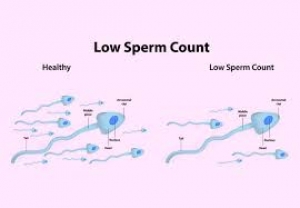‘Alcohol, sugar, unhealthy food responsible for low sperm count’